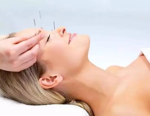 面部针灸可以美容
